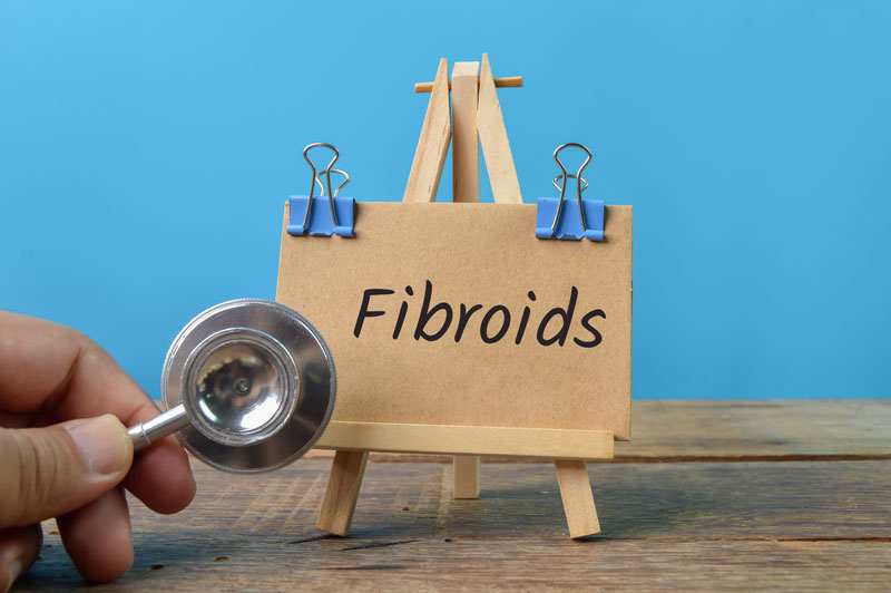 Living with Fibroids