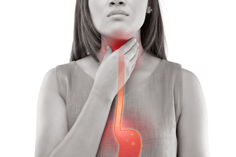 Why do you have Acid Reflux?