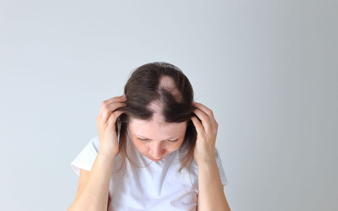 How Alopecia Affects Daily Life – And Why Research Matters