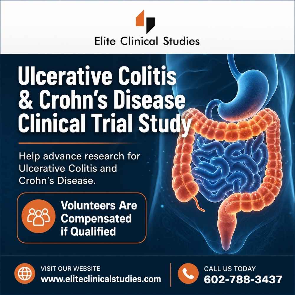 Ulcerative Colitis and Crohn’s Disease Clinical Trial Study